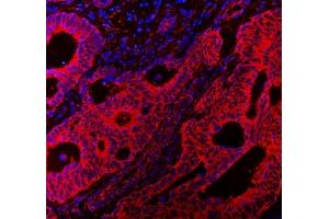 IF analysis of VAPA using anti-VAPA antibody (ABIN7603249). (VAPA 抗体  (N-Term))