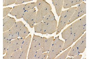 ABIN7093979 and ABIN7098023 at 1/100 staining Mouse kidney tissue by IHC-P.