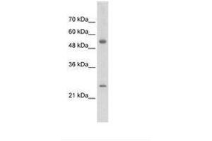 Image no. 1 for anti-Adenylate Kinase 4 (AK4) (AA 126-175) antibody (ABIN203378) (AK4 抗体  (AA 126-175))