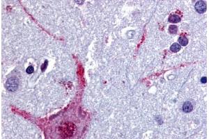 Human Brain, Cortex (formalin-fixed, paraffin-embedded) stained with CHRM3 antibody ABIN213349 at 5 ug/ml followed by biotinylated goat anti-rabbit IgG secondary antibody ABIN481713, alkaline phosphatase-streptavidin and chromogen. (CHRM3 抗体  (Cytoplasmic Domain))