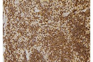 ABIN6277712 at 1/100 staining Rat spleen tissue by IHC-P. (TP53BP1 抗体  (N-Term))