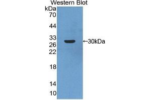 Detection of Recombinant ARNT2, Human using Polyclonal Antibody to Aryl Hydrocarbon Receptor Nuclear Translocator 2 (ARNT2) (ARNT2 抗体  (AA 1-209))
