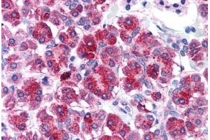 Human Pancreas (formalin-fixed, paraffin-embedded) stained with TLR3 antibody ABIN214574 at 5 ug/ml followed by biotinylated goat anti-rabbit IgG secondary antibody ABIN481713, alkaline phosphatase-streptavidin and chromogen. (TLR3 抗体  (N-Term))