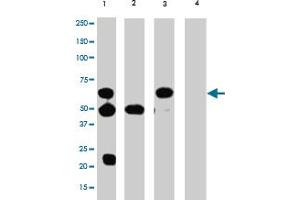 Immunoprecipitation (IP) / Western Blot (WB) Analysis of TERF2 in HL-60 cells : (Lane 1) IP with mouse TERF2 monoclonal antibody, clone 4A794. (TRF2 抗体)