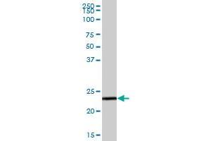 GSTZ1 MaxPab polyclonal antibody. (GSTZ1 抗体  (AA 1-216))