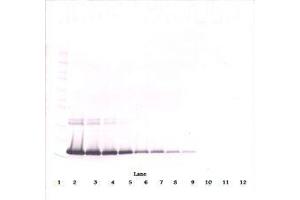 Image no. 1 for anti-Interleukin 2 (IL2) antibody (ABIN465129) (IL-2 抗体)