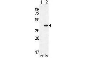 Western blot analysis of CLEC11A (arrow) using rabbit polyclonal CLEC11A Antibody (Center) . (CLEC11A 抗体  (Middle Region))