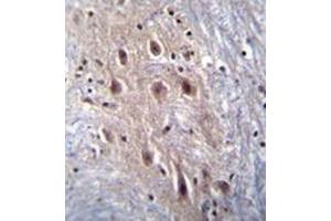 Immunohistochemistry analysis in formalin fixed and paraffin embedded human brain tissue reacted with HIPK4 Antibody  followed by peroxidase conjugation of the secondary antibody and DAB staining. (HIPK4 抗体)