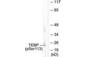 Western blot analysis of extracts from NIH-3T3 cells treated with EGF 200ng/ml 30', using TEBP (Phospho-Ser113) Antibody. (NKX2-1 抗体  (pSer113))