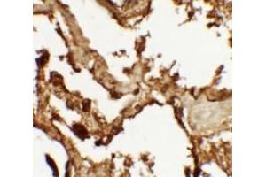 Immunohistochemistry of VKORC1 in human lung tissue with VKORC1 antibody at 2. (VKORC1 抗体  (N-Term))