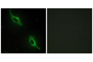 Immunofluorescence analysis of NIH/3T3 cells, using CKMT2 antibody. (CKMT2 抗体  (Internal Region))