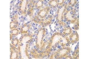 Immunohistochemistry of paraffin-embedded Rat kidney using EYA3 Polyclonal Antibody at dilution of 1:100 (40x lens). (EYA3 抗体)