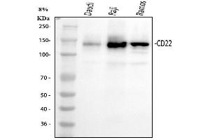 Western blot analysis of CD22 using anti-CD22 antibody (ABIN3043390). (CD22 抗体  (C-Term))
