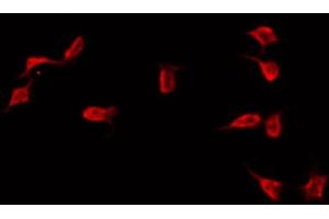 ABIN6272289 staining COLO205 by IF/ICC. (DNAI1 抗体  (C-Term))