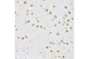 Immunohistochemistry of paraffin-embedded rat brain using SATB1 antibody (ABIN5973417) at dilution of 1/100 (40x lens). (SATB1 抗体)