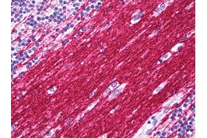 Anti-PLP1 antibody IHC of human brain cerebellum, neuropil. (PLP1 抗体  (C-Term))