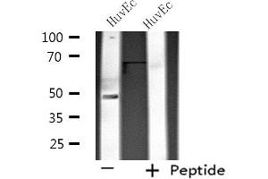 Western blot analysis of extracts from HuvEc cells using SIRPB1 antibody. (SIRPB1 抗体)