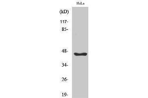 Western Blotting (WB) image for anti-serpin Peptidase Inhibitor, Clade B (Ovalbumin), Member 12 (SERPINB12) (Internal Region) antibody (ABIN6282249)
