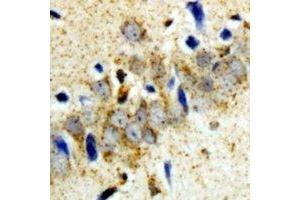 Immunohistochemical analysis of GCN2 staining in rat brain  formalin fixed paraffin embedded tissue section. (GCN2 抗体)
