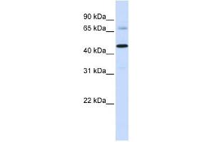 Sideroflexin 4 antibody used at 1 ug/ml to detect target protein. (Sideroflexin 4 抗体  (C-Term))