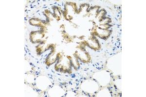 Immunohistochemistry of paraffin-embedded rat lung using S100/Psoriasin antibody (ABIN3015738, ABIN3015739, ABIN3015740 and ABIN6219085) at dilution of 1:100 (40x lens). (S100A7 抗体  (AA 1-101))