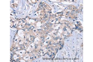 Immunohistochemistry of Human brain  using KCNQ5 Polyclonal Antibody at dilution of 1:60 (KCNQ5 抗体)