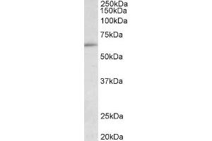 ABIN1049504 (0. (HIC2 抗体  (AA 188-200))