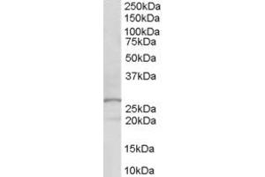 Western Blotting (WB) image for anti-Docking Protein 5 (DOK5) (AA 293-306) antibody (ABIN299685) (DOK5 抗体  (AA 293-306))