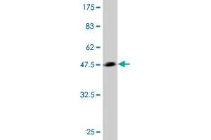 Western Blot detection against Immunogen (43. (TWIST2 抗体  (AA 1-160))