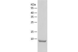 Western Blotting (WB) image for Chemokine (C-C Motif) Ligand 21 (CCL21) (AA 24-133) protein (His tag) (ABIN7122282) (CCL21 Protein (AA 24-133) (His tag))