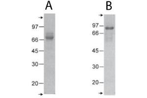 SDS-PAGE of recombinant rat COMP (T3+TC). (COMP Protein (C-Term))