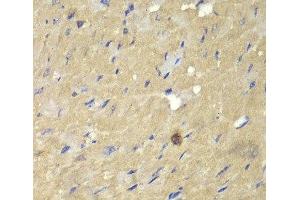 Immunohistochemistry of paraffin-embedded Mouse heart using AKR7A2 Polyclonal Antibody at dilution of 1:100 (40x lens). (AKR7A2 抗体)