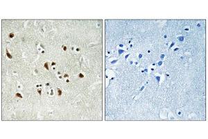 Immunohistochemistry analysis of paraffin-embedded human brain tissue using TUBGCP6 antibody. (GCP6 抗体  (Internal Region))