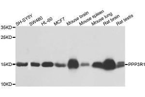 Western blot analysis of extracts of various cell lines, using PPP3R1 antibody. (PPP3R1 抗体  (AA 11-170))