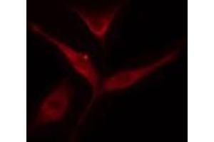 ABIN6274546 staining COLO205 cells by IF/ICC. (IKZF3 抗体  (Internal Region))