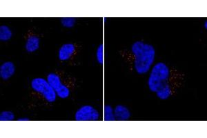 Immunofluorescent staining of HeLa cells incubated with MIB1 polyclonal antibody . (MIB1 抗体  (N-Term))
