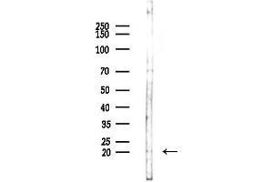Western blot analysis of lysates from COLO205 cells(UV,30 min treatment), using CL2 Antibody at 1/1000 dilution. (CD164L2 抗体)