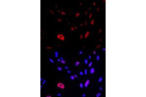 Immunofluorescence analysis of U2OS cells using HUS1 antibody (ABIN6131777, ABIN6142085, ABIN6142087 and ABIN6221056). (HUS1 抗体  (AA 1-280))