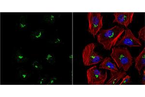 ICC/IF Image VBP1 antibody detects VBP1 protein at cytoplasm by immunofluorescent analysis. (VBP1 抗体  (Center))