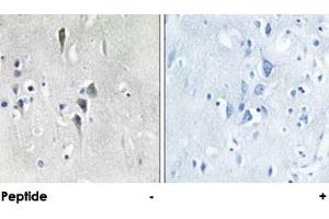 Immunohistochemical analysis of paraffin-embedded human brain tissue using CAMK2A/CAMK2D polyclonal antibody . (CAMK2A 抗体)