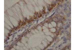 Image no. 1 for anti-rho-Associated, Coiled-Coil Containing Protein Kinase 2 (ROCK2) (N-Term) antibody (ABIN1495063) (ROCK2 抗体  (N-Term))