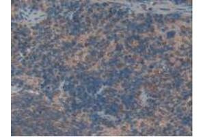 Detection of HK1 in Rat Spleen Tissue using Polyclonal Antibody to Hexokinase 1 (HK1) (Hexokinase 1 抗体  (AA 413-540))