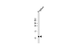 Anti-BP Antibody (N-term) at 1:1000 dilution + human spleen lysate Lysates/proteins at 20 μg per lane. (CXCL7 抗体  (N-Term))