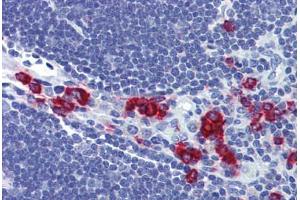 Immunohistochemistry (Formalin-fixed Paraffin-embedded Sections) (IHC (fp)) image for anti-Ras Association (RalGDS/AF-6) Domain Family Member 2 (RASSF2) (AA 11-22) antibody (ABIN462512)