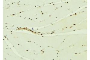 ABIN6276900 at 1/100 staining Mouse muscle tissue by IHC-P. (KEAP1 抗体  (N-Term))
