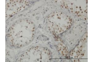 Immunoperoxidase of monoclonal antibody to CTNNBL1 on formalin-fixed paraffin-embedded human testis. (CTNNBL1 抗体  (AA 210-311))