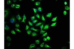 Immunofluorescence staining of Hela cells with ABIN7168990 at 1:141, counter-stained with DAPI. (STK3 抗体  (AA 323-450))