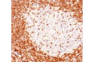 IHC testing of human tonsil stained with Bcl-2 antibody (8C8). (Bcl-2 抗体  (AA 41-54))