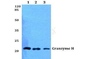 Western blot (WB) analysis of Granzyme H antibody  at 1/500 dilution. (GZMH 抗体)