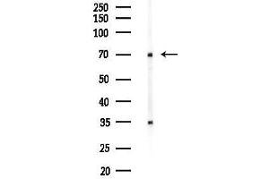 anti-WAS Protein Family, Member 1 (WASF1) (Internal Region) antibody